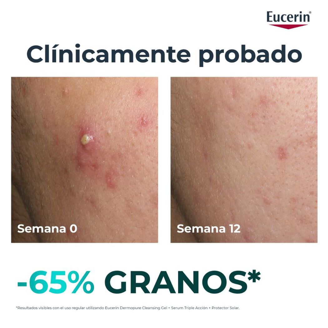 Serum Facial Eucerin Dermopure Clinical Triple Corrector 40ml, , large image number 3