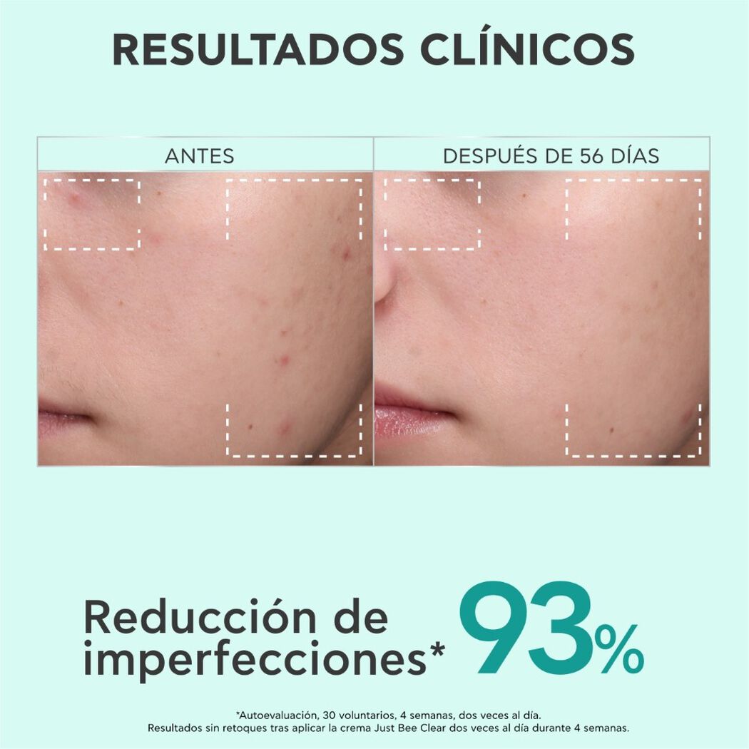 Apivita Crema Anti-Imperfeciones Hidrataci&oacute;n 40Ml, , large image number 4