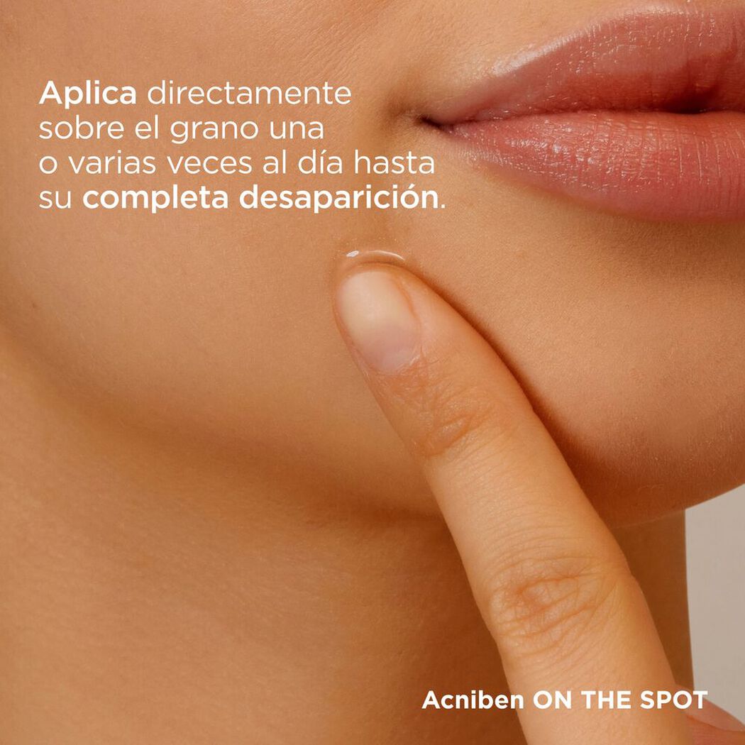 Isdin Gel Corrector Acniben On The Spot x 15 mL, , large image number 3