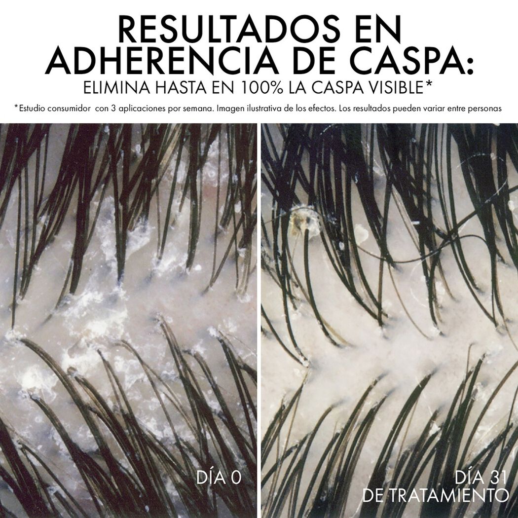 Shampoo Dercos Anti-Caspa DS Eco-Refill 390 mL, , large image number 2