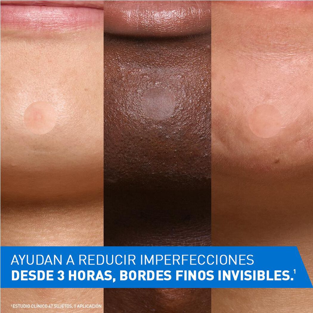 Parches Control de Imperfecciones 22un, , large image number 2