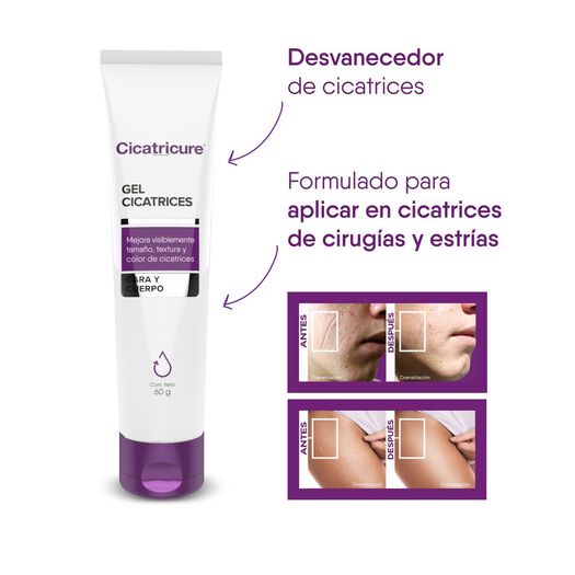 Cicatricure Gel 60 G, , large image number 4