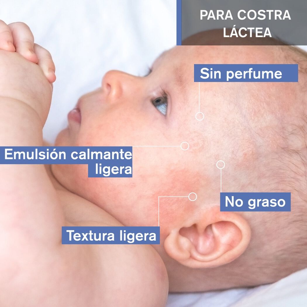 Bebe 1st Cradle Cap Care T 40ml, , large image number 2