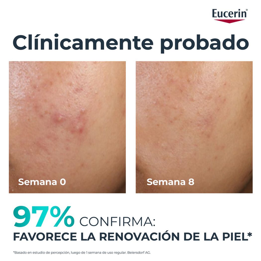 Crema Eucerin Dermopure Oil Control Acci&oacute;n Intensiva 40 mL, , large image number 4